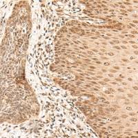 兔抗ARMC8多克隆抗体