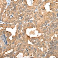 兔抗C1GALT1C1多克隆抗体