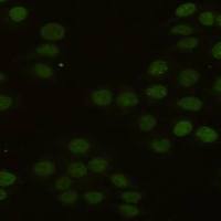 小鼠抗PCNA单克隆抗