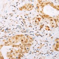 兔抗SPIN2B多克隆抗体