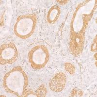 兔抗PFDN2多克隆抗体