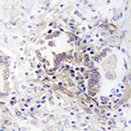 兔抗CHML多克隆抗体