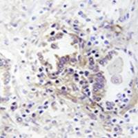 兔抗CHML多克隆抗体