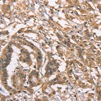 兔抗PEBP1多克隆抗体