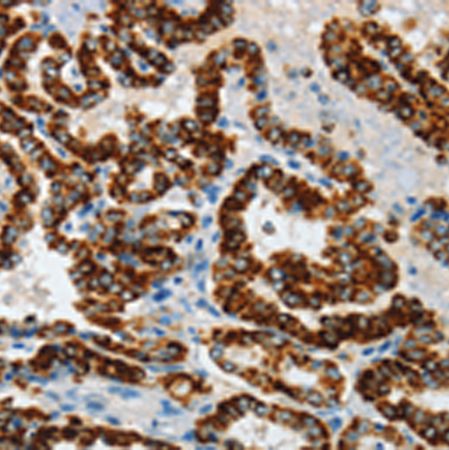 兔抗ASB4多克隆抗体