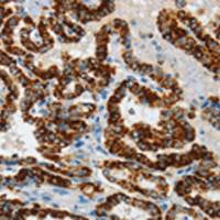 兔抗ASB4多克隆抗体