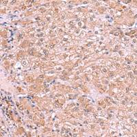 兔抗RIC3多克隆抗体