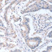 兔抗ACOT9多克隆抗体