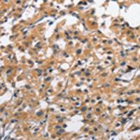 兔抗CLEC2D多克隆抗体