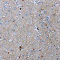 兔抗ADORA2B多克隆抗体