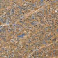 兔抗TNFSF13B多克隆抗体