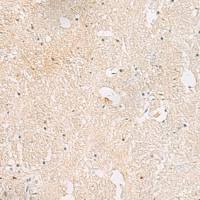 兔抗AKAP3多克隆抗体