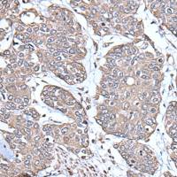 兔抗PGRMC1多克隆抗体