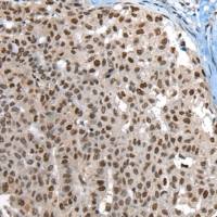 兔抗UBR7多克隆抗体