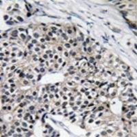 兔抗MRPL24多克隆抗体