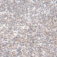 兔抗GNLY多克隆抗体