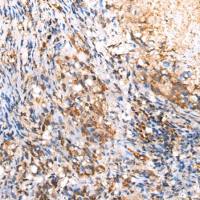 兔抗RIMKLB多克隆抗体