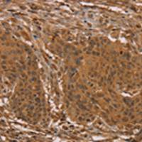 兔抗PRC1多克隆抗体