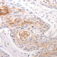 兔抗DFFB多克隆抗体