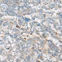 兔抗STS多克隆抗体