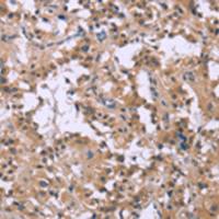 兔抗CSF2RB多克隆抗体