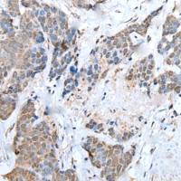 兔抗UBA6多克隆抗体