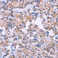 兔抗DUSP22多克隆抗体