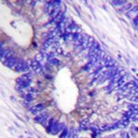 兔抗PRKACA(Phospho-Thr197)多克隆抗体