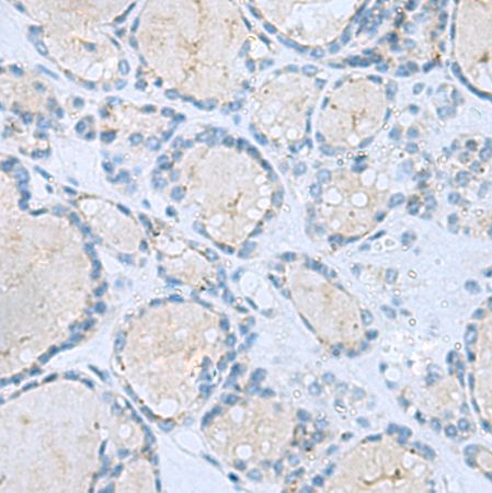 兔抗MSI2多克隆抗体