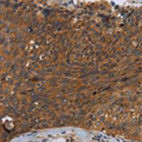 兔抗CSF2RA多克隆抗体