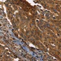 兔抗PPIA多克隆抗体