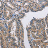 兔抗TLR8多克隆抗体