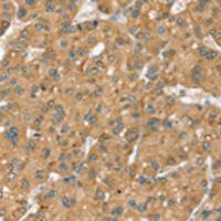 兔抗SEC14L2多克隆抗体