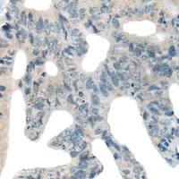 兔抗MAP2K7多克隆抗体