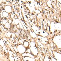 兔抗ABCC4多克隆抗体