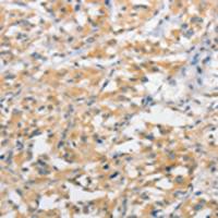 兔抗ATG10多克隆抗体