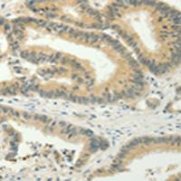 兔抗SPIN4多克隆抗体