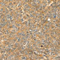 兔抗GRB2多克隆抗体