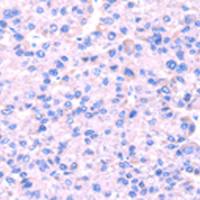 兔抗SRPK1多克隆抗体