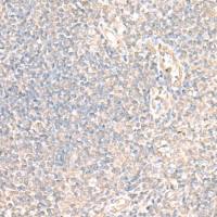 兔抗PARS2多克隆抗体