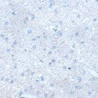 兔抗PNLIPRP1多克隆抗体