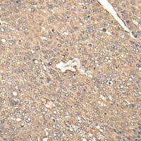 兔抗BDH2多克隆抗体