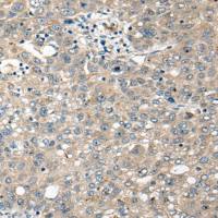 兔抗CDK20多克隆抗体