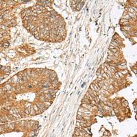 兔抗GNAT1多克隆抗体