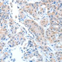 兔抗ADAMTSL1多克隆抗体