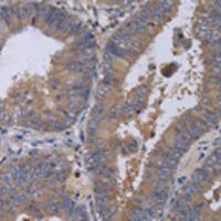 兔抗MKKS多克隆抗体