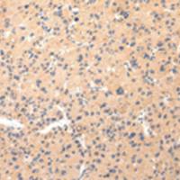 兔抗COL8A2多克隆抗体