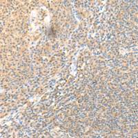 兔抗SSC4D多克隆抗体