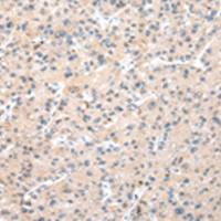 兔抗WDR77多克隆抗体