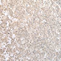 兔抗CISH多克隆抗体